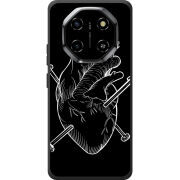 Чохол BoxFace Blackview Shark 6 