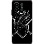 Чохол BoxFace Blackview Wave 10 