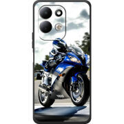 Чохол BoxFace Xiaomi Redmi 17 