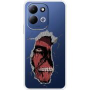 Прозорий чохол BoxFace Xiaomi Redmi 17 Нападение Титана