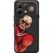 Прозорий чохол BoxFace Infinix Note 60 Pro Титан