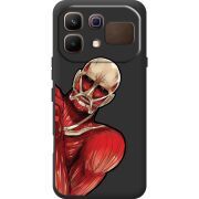 Прозорий чохол BoxFace Infinix Note 60 Титан