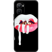 Чохол BoxFace Infinix GT 50 Pro 