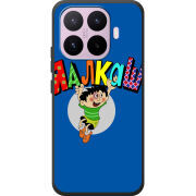 Чохол BoxFace Xiaomi 17T 