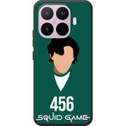 Чохол BoxFace Xiaomi 17T siquid game 456