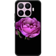 Чохол BoxFace Xiaomi 17T 
