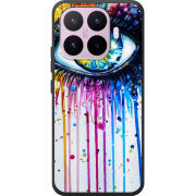 Чохол BoxFace Xiaomi 17T 
