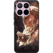Чохол BoxFace Xiaomi 17T 