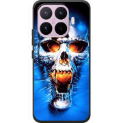 Чохол BoxFace Xiaomi 17T 
