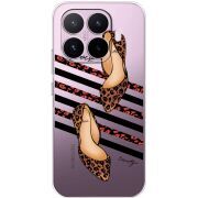 Прозорий чохол BoxFace Xiaomi 17T Love Beauty