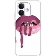 Чохол BoxFace Xiaomi Redmi Note 17 Pro 