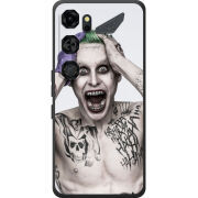 Чохол BoxFace Nubia Neo 5 GT 5G 