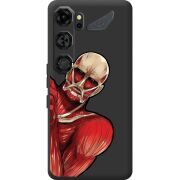 Чорний чохол BoxFace Nubia Neo 5 GT 5G Титан