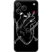 Чохол BoxFace Nubia V80 Design 