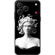 Чохол BoxFace Nubia V80 Design 