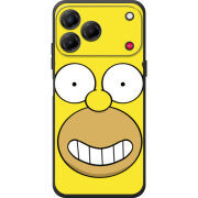 Чохол BoxFace Nubia V80 Design 