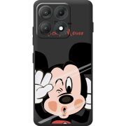 Прозорий чохол BoxFace Moto Edge 70 Max Mister M