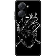 Чохол BoxFace Xiaomi Redmi A7 