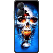Чохол BoxFace Xiaomi Redmi A7 
