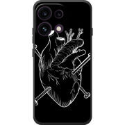 Чохол BoxFace OPPO Reno 16F 