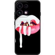 Чохол BoxFace OPPO Reno 16 Pro 