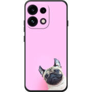 Чохол BoxFace OPPO Reno 16 Pro 
